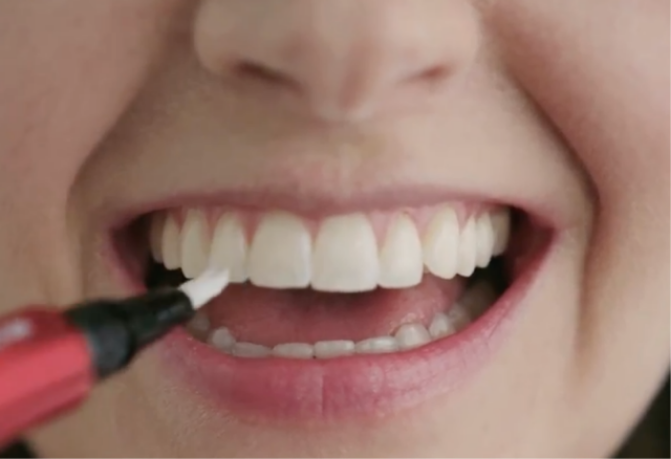 Nainen käyttää Colgate White Overnight kynää Nainen levittää kynän seerumia hampaiden pinnalle