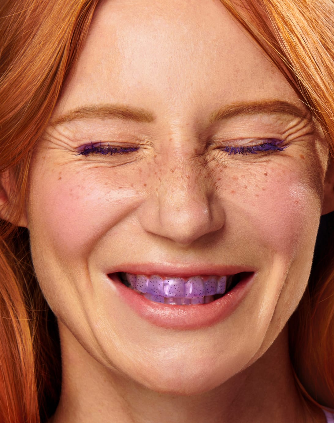 Hymyilevä nainen, jonka hampaat ovat purppuratahnan peittämät